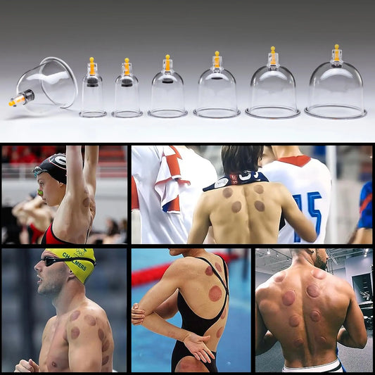 Uplife Set de 24 Ventosas Fisioterapia - Ventosa terapia con Imanes Terapéuticos Uplife